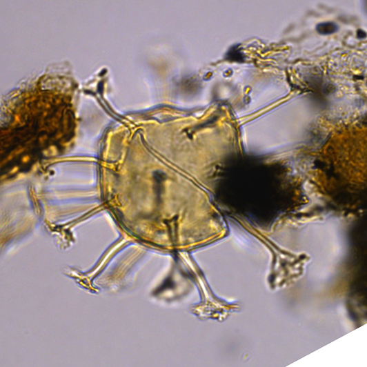 Hystrichosphaeridium tubiferum Htel27X3606210 40x.jpg